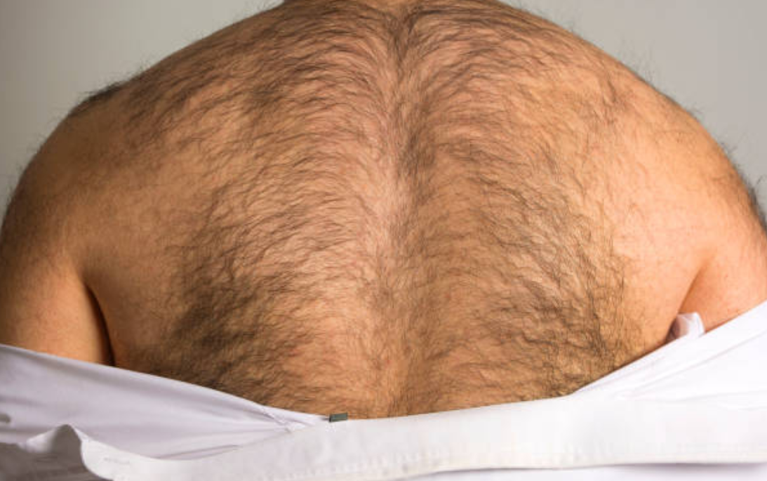 Men hairy ass 25 Reasons
