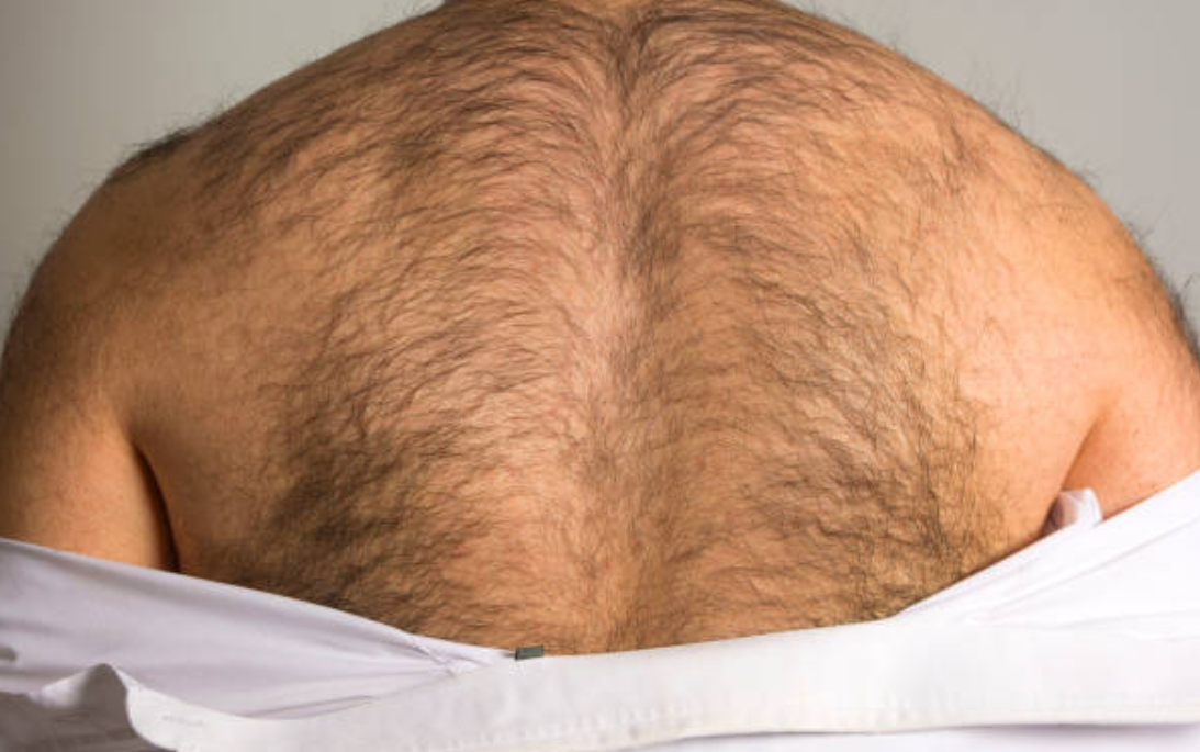 Hairy Butt Picture